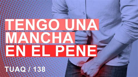 manchas en el pen negras|Manchas oscuras en el pene: causas